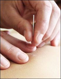 Hand holding acupuncture needle over skin