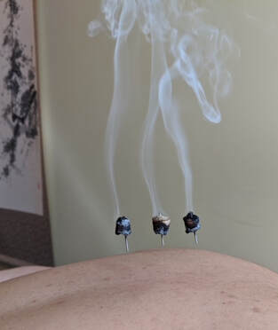 human skin with three acupuncture needles holding needle-top moxa, smoke emerging from the burning moxa, ink-brush painting hanging on the wall in background
