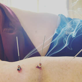 acupuncture and direct moxibustion on a person's arm
